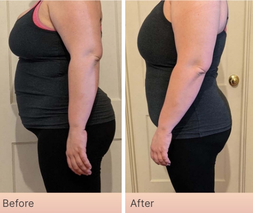 Before and After Real Result pictures of a person who has used the NeoraFit System - 3