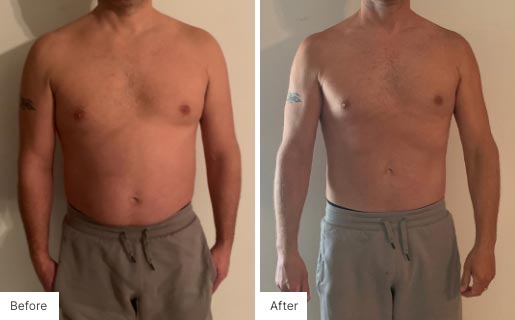 6 - Before and After of a man's body using NeoraFit.
